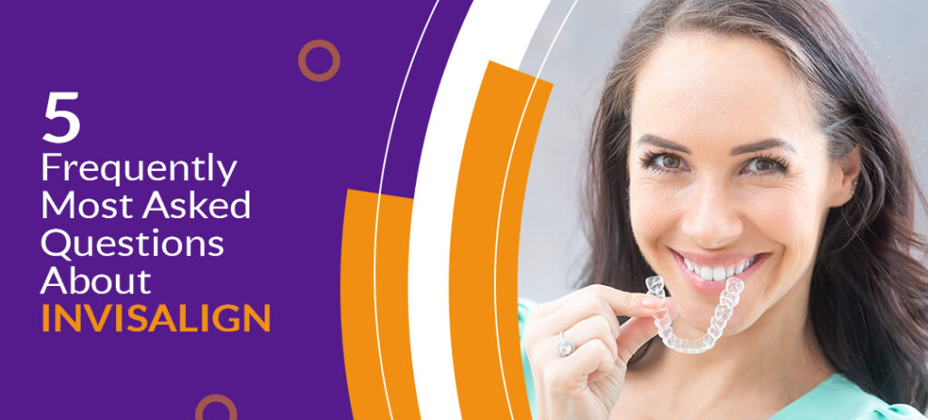 5 Frequently Most Asked Questions About Invisalign - Cosmetic Dentistry Clinic