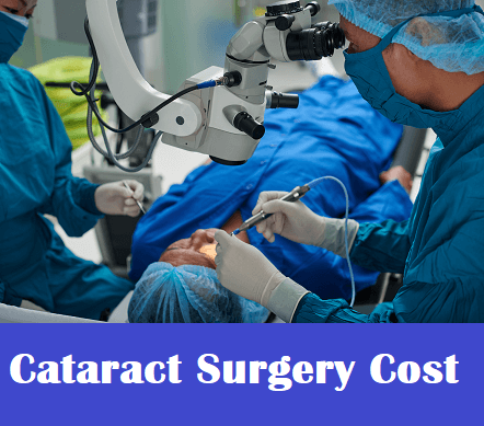 cataract-surgery-cost