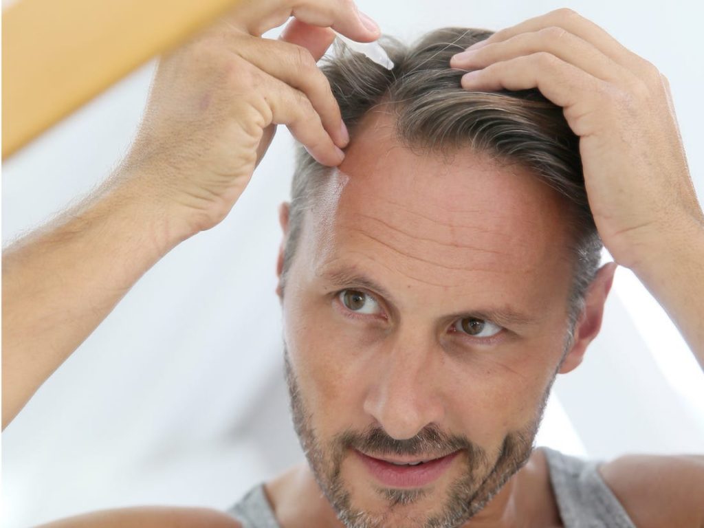 hair transplant treatment for falling hair