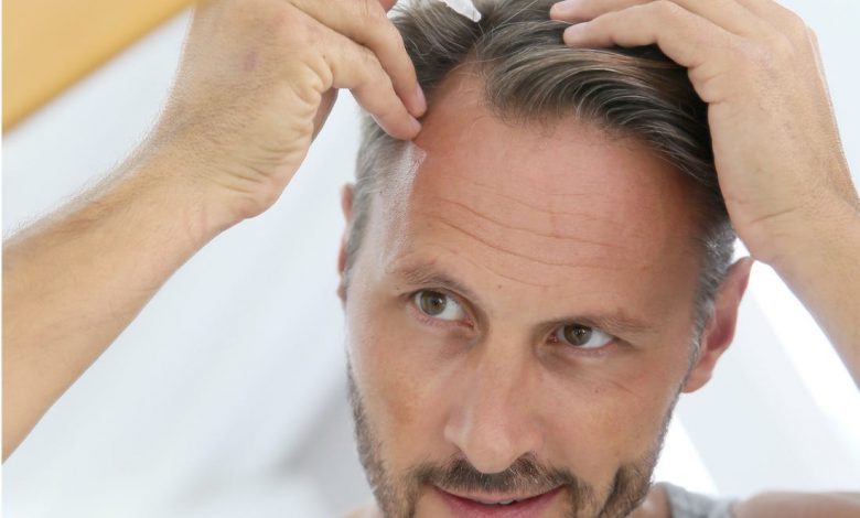 hair transplant treatment for falling hair