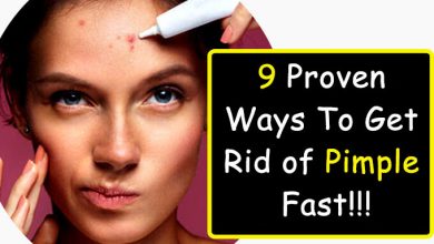 Photo of 9 Proven ways to get rid of Pimples fast!!!