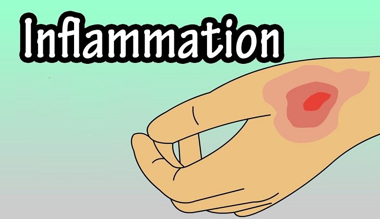 Inflammation – Is It Really Bad? Myths Dispelled