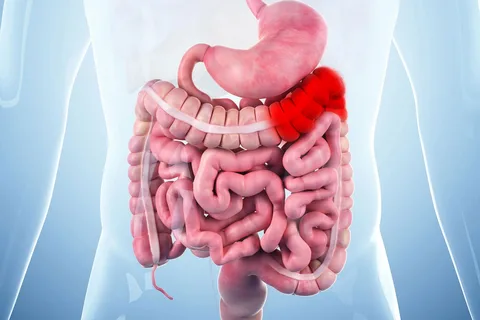 Gastrointestinal